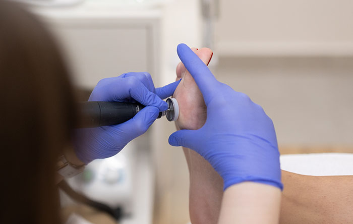 Medicinski pedikir